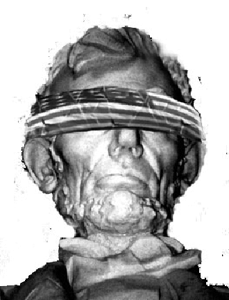 [IMAGE - blindfolded Lincoln]
